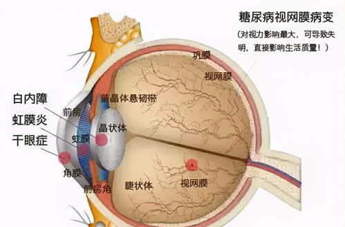 恋爱后遗症游戏下载 